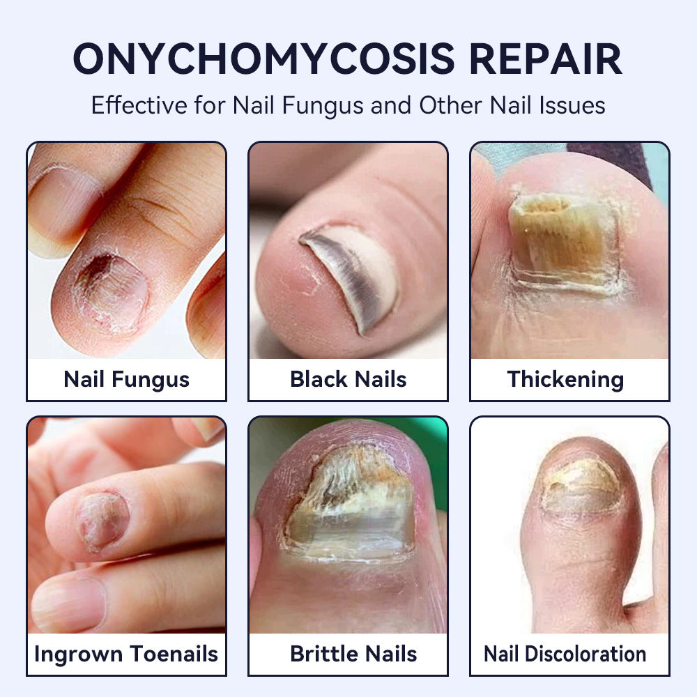 Nail Care Repair Pen – Solution for Damaged Nails