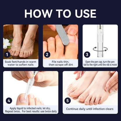 Nail Care Repair Pen – Solution for Damaged Nails