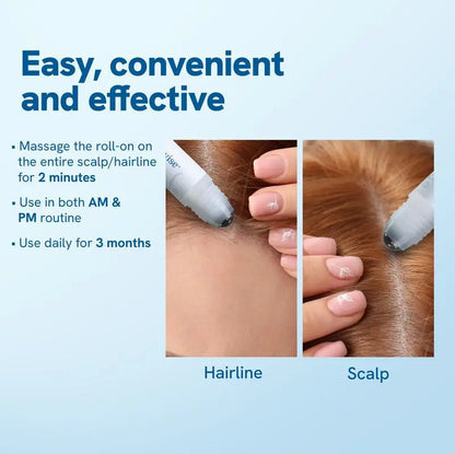 Hair Growth Concentrate Roll-On Serum