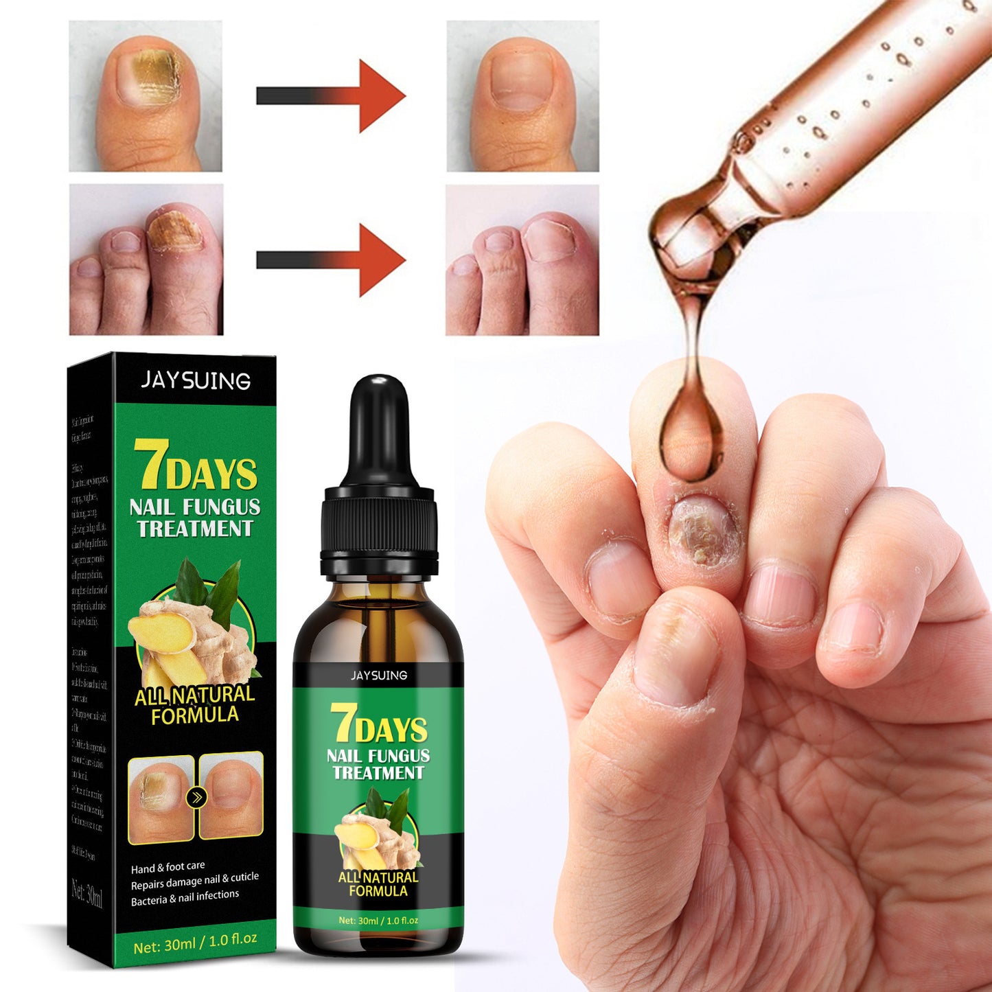 7-Day Rapid Nail Care & Repair Essence (Natural Ginger Formula)
