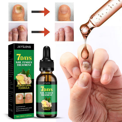 7-Day Rapid Nail Care & Repair Essence (Natural Ginger Formula)