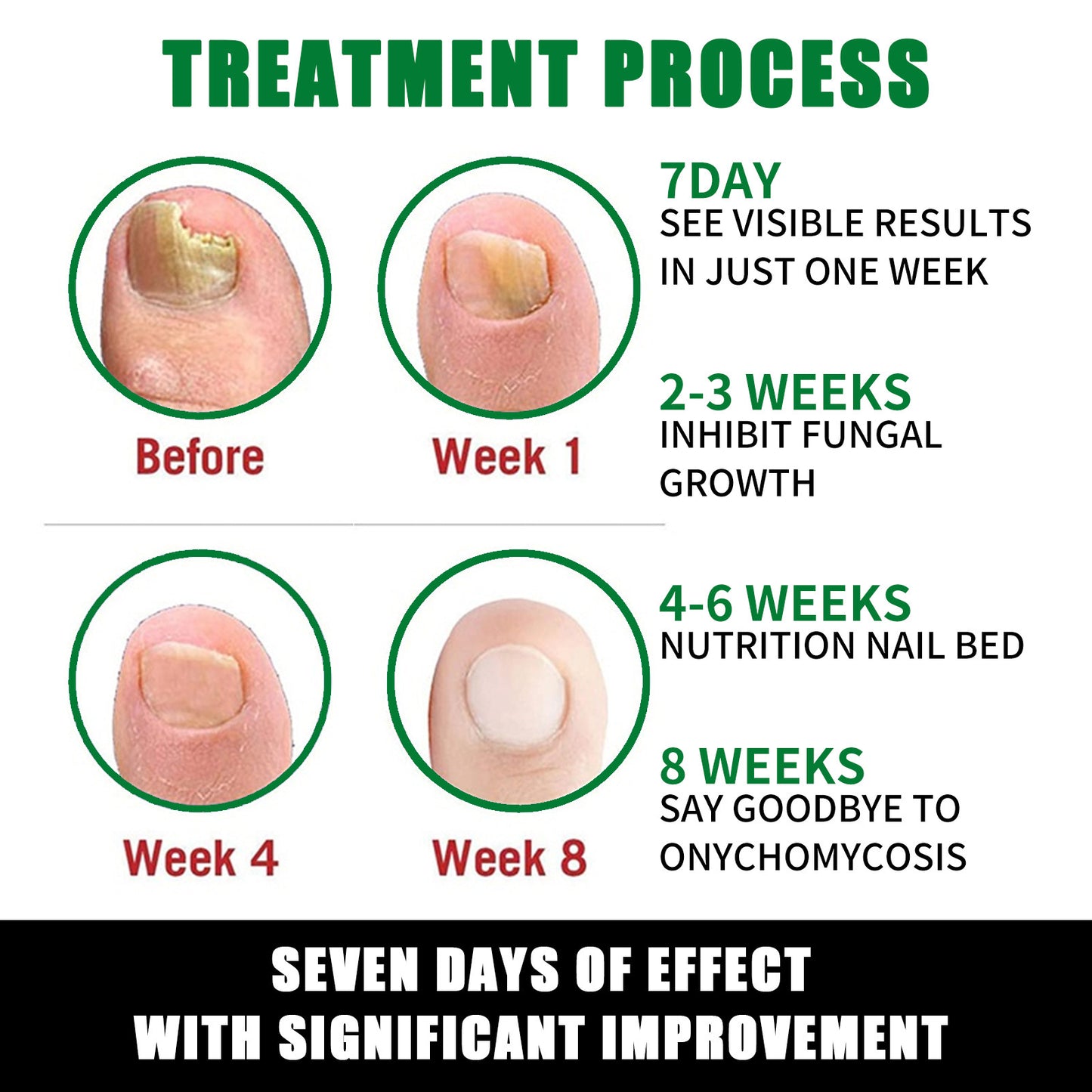 7-Day Rapid Nail Care & Repair Essence (Natural Ginger Formula)