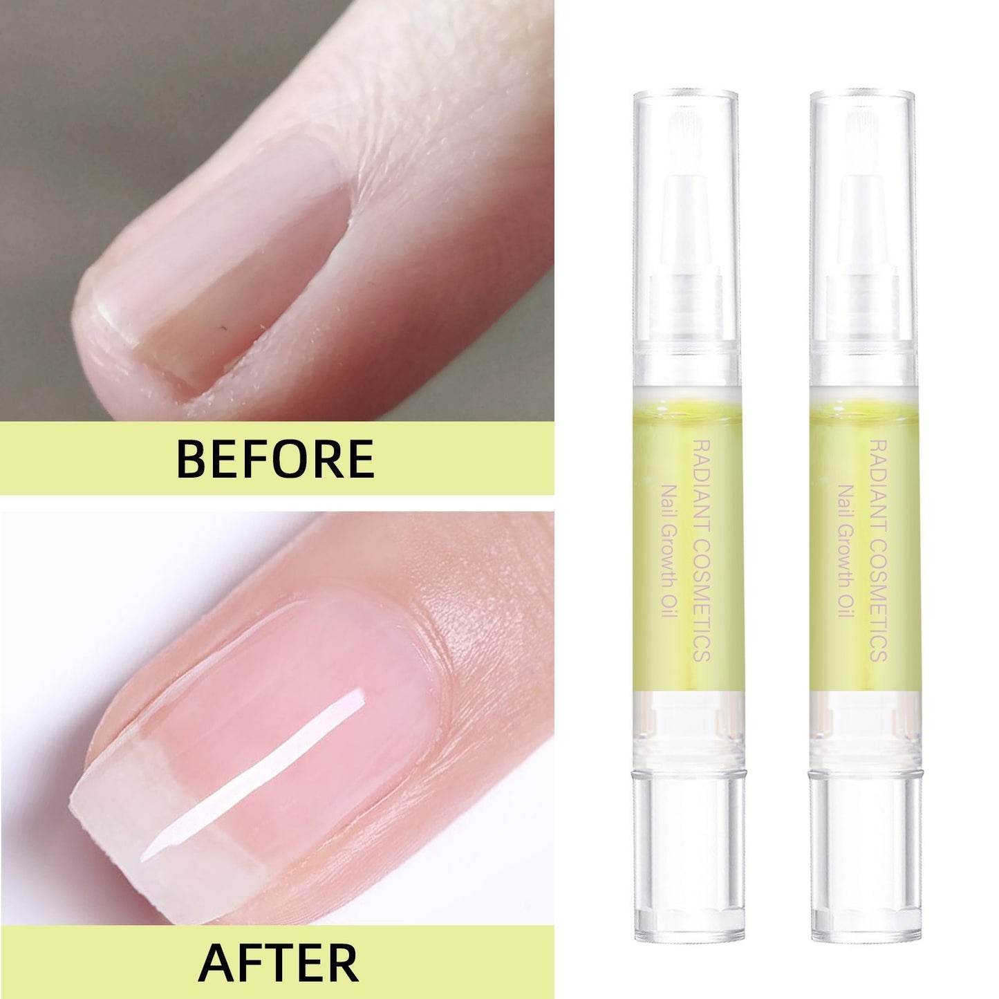 Radiant Nail Growth & Repair Oil Pen (with Biotin & Vitamin E)