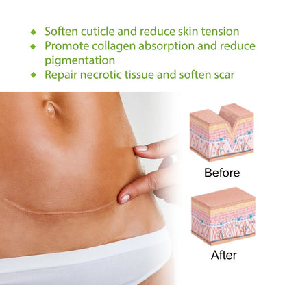 Silicone Gel Skin Tape Roll Custom Size