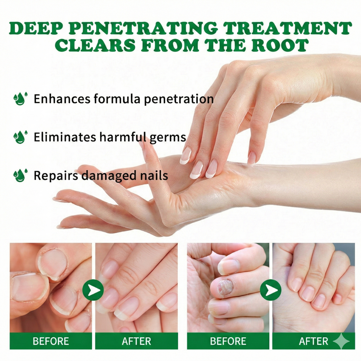 7-Day Rapid Nail Care & Repair Essence (Natural Ginger Formula)