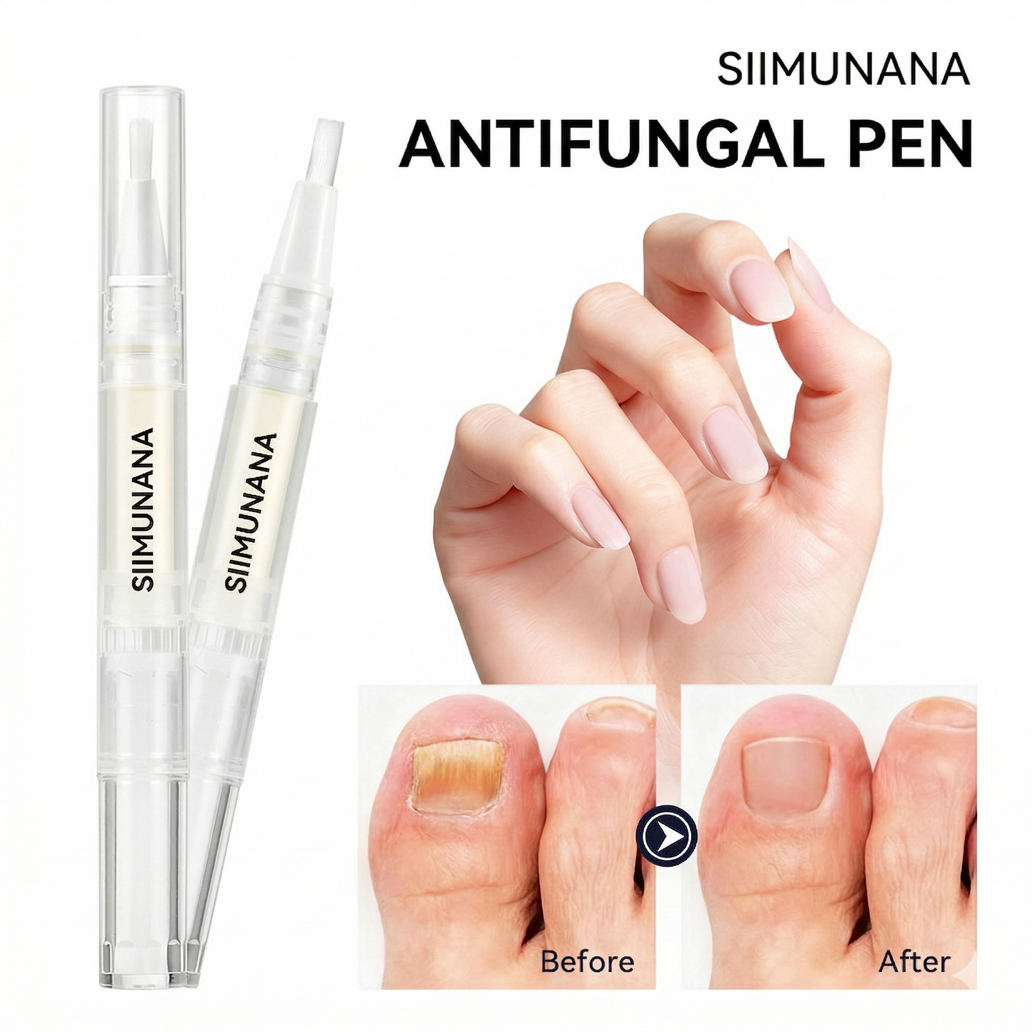 Nail Care Repair Pen – Solution for Damaged Nails