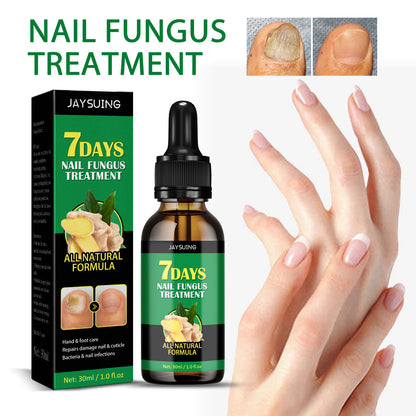7-Day Rapid Nail Care & Repair Essence (Natural Ginger Formula)