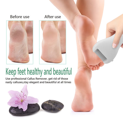 Rechargeable Electric Foot Callus Remover with Smart LED Display