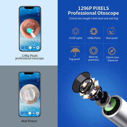 Smart Visual Ear Cleaner with HD Camera & App View