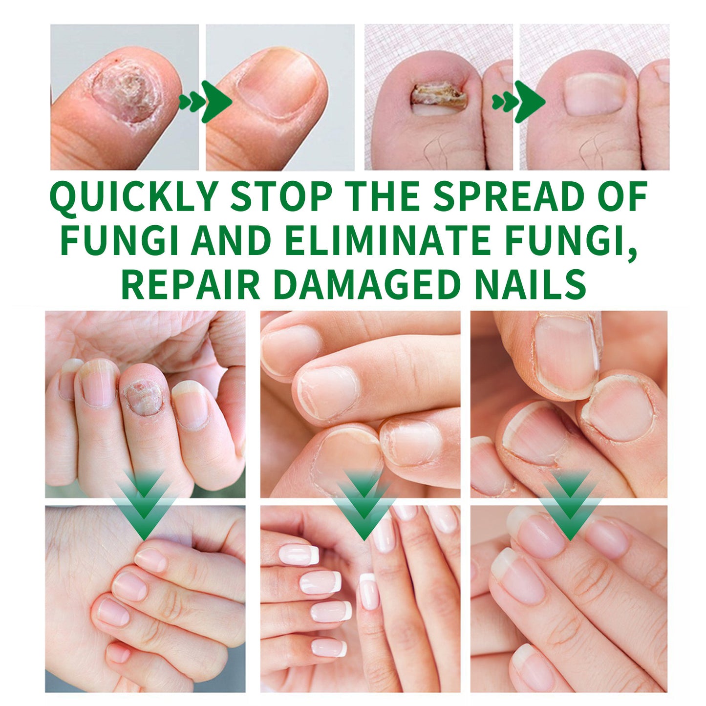 7-Day Rapid Nail Care & Repair Essence (Natural Ginger Formula)