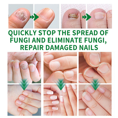 7-Day Rapid Nail Care & Repair Essence (Natural Ginger Formula)